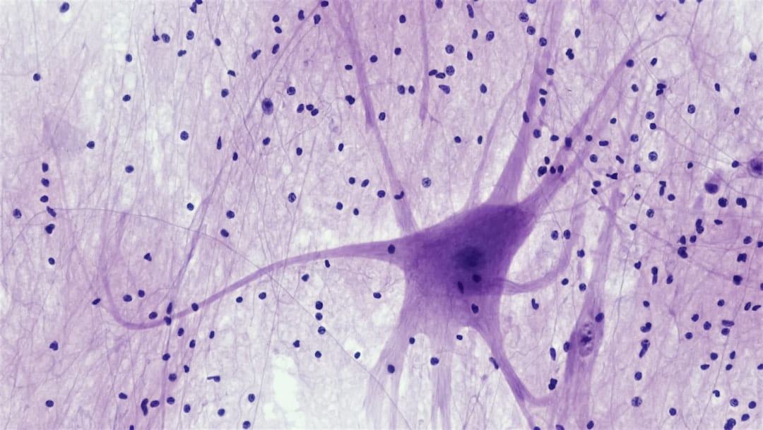 Neuralink приглашает пациентов для испытаний мозговых имплантов